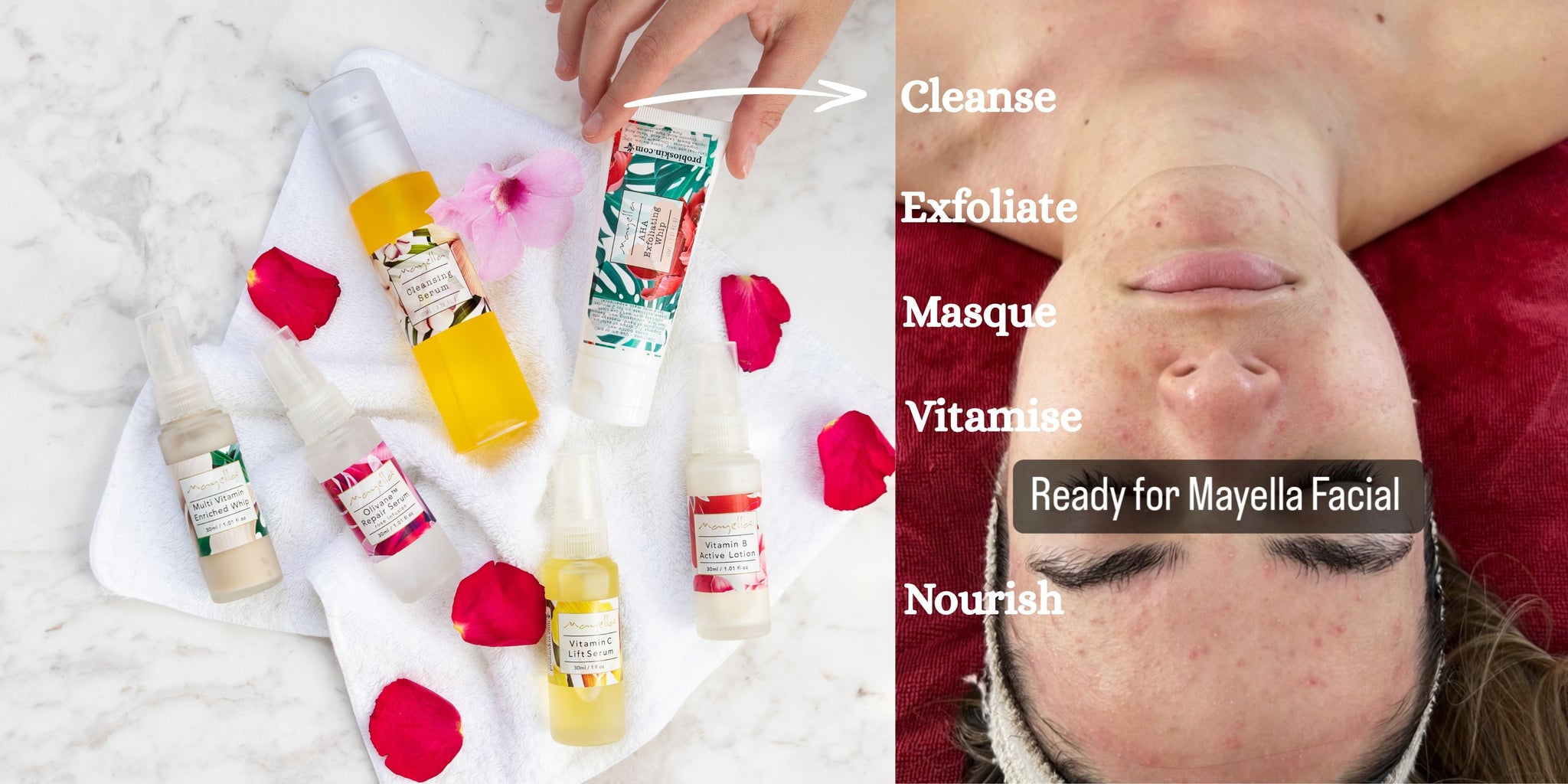 Natural Skincare for Reactive Skin: Supporting Sensitive Skin, Rosacea & Chronic Illness